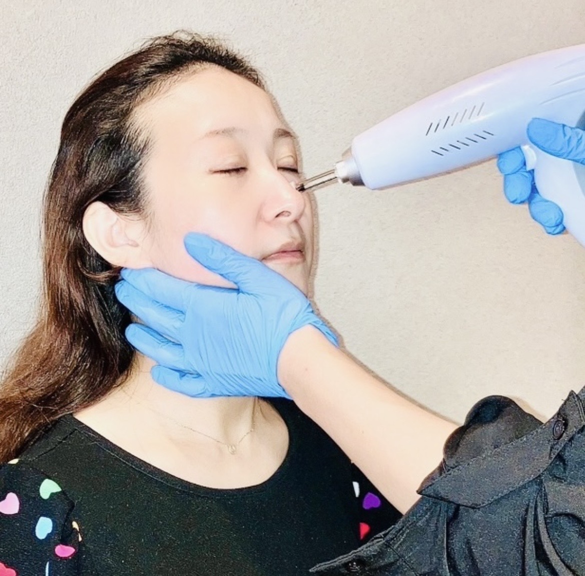 フェイシャルケアを行う手元